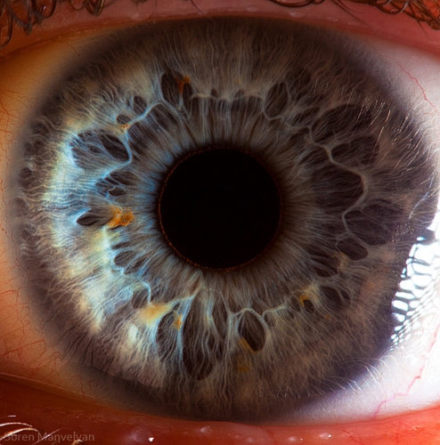 Eye 10